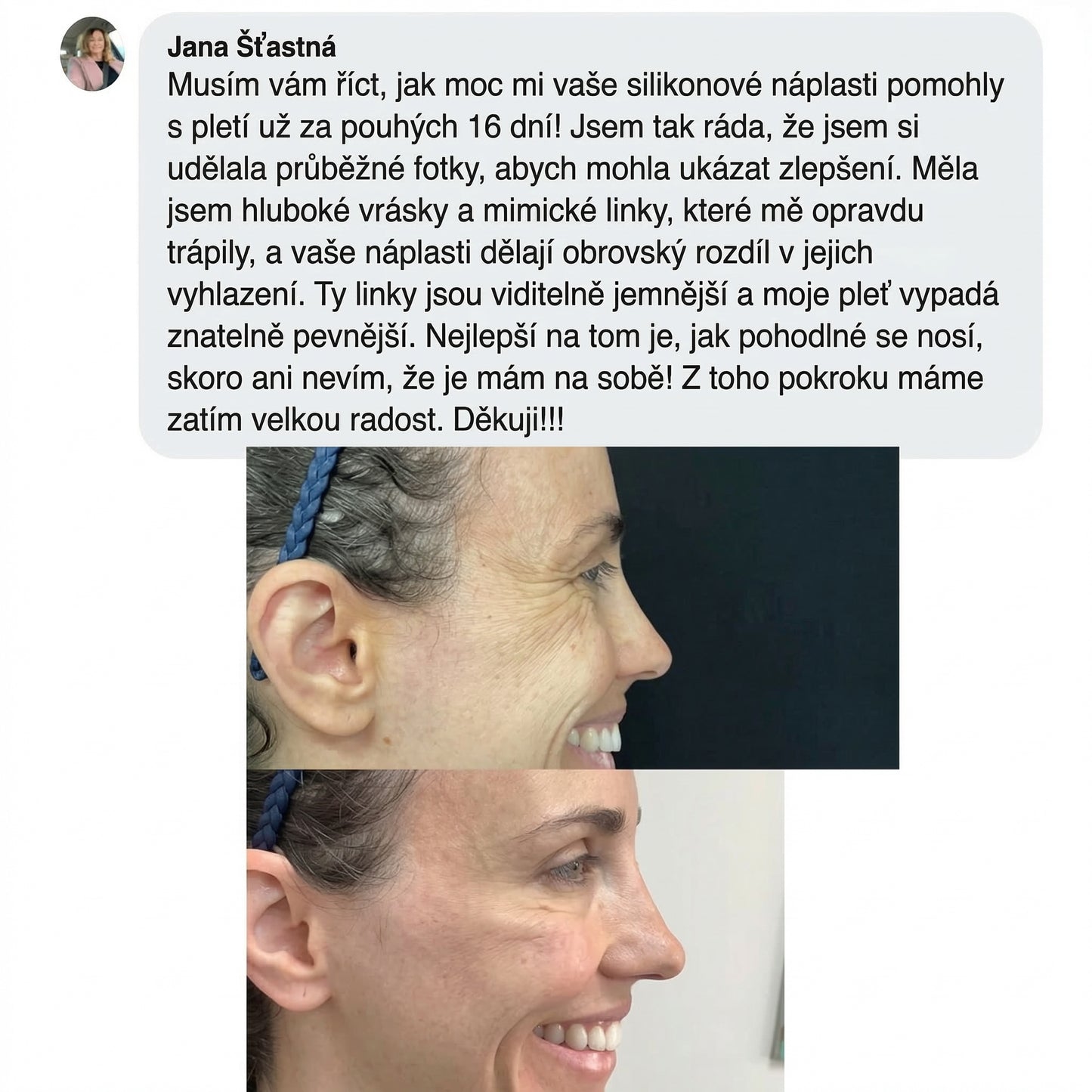 Tolvos™ - Silikonové plátky na jizvy